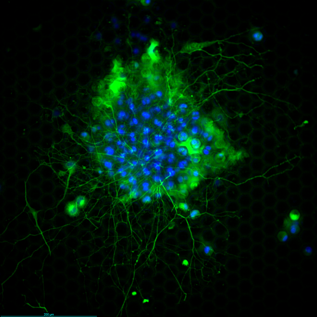 On Chip Neural Differentiation Of PC12 Cells SIEVEWELL